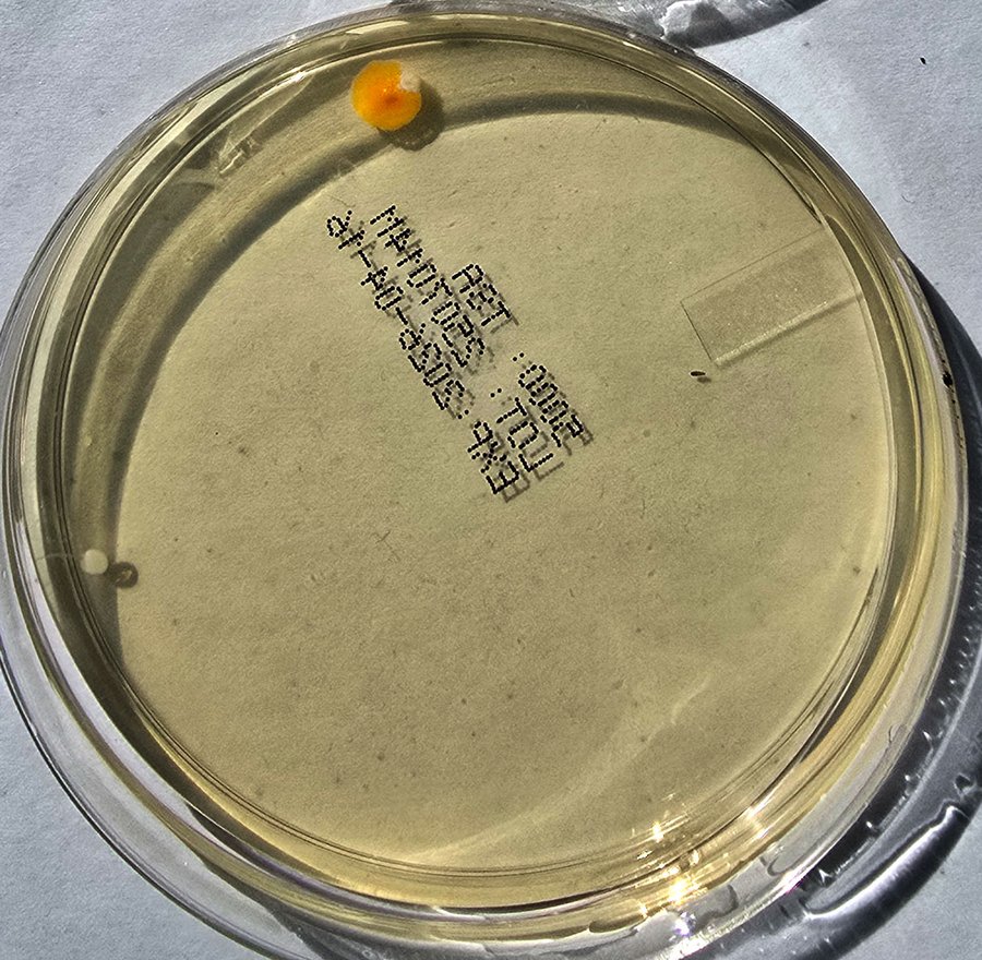 Room air sample plate, nearly clean